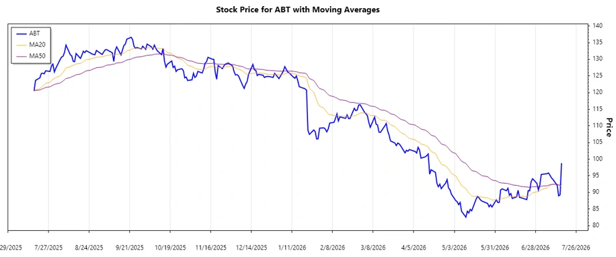 Stock chart trend analysis