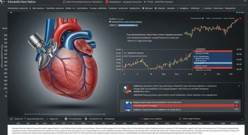 EW: Analysts Ratings - Edwards Lifesciences Corporation